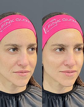 Gift Card Vitaminas para tu piel con 1 Sesión de Pink Glow