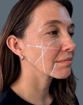 Baby Glow, el despertar de la luminosidad con 3 ml de HA