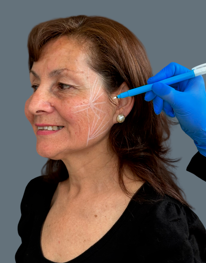 https://www.estetikamedica.cl/cyber-flacidez-facial-5-bioestimuladores-para-recuperar-la-firmeza