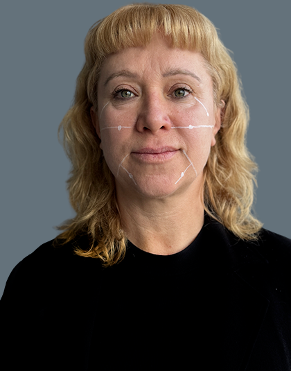 https://www.estetikamedica.cl/rejuvenecimiento-facial-cyber-2026-la-guia-completa-para-elegir