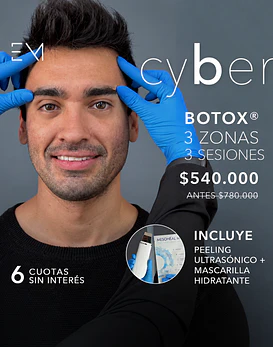 Toxina 3 zonas + Peeling ultrasonico + Mascara 3 ses.