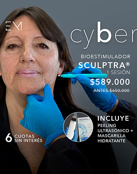 Sculptra 1 sesion + Peeling ultrasonico + Mascara 