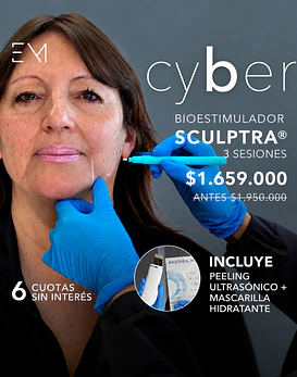 Sculptra 3 ses  + Peeling ultrasonico + Mascara