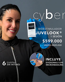 Juvelook Volume + Microneedling + exosoma 