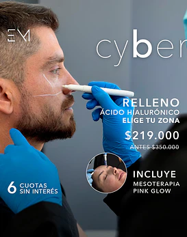 relleno 1 zona + mesoterapia pink glow