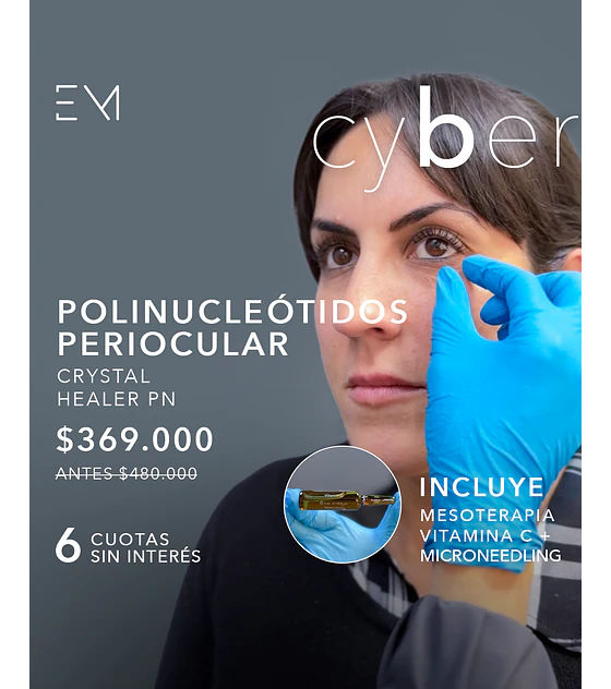 Polinucléotidos Periocular + Vitamina C + microneedling