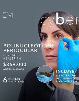 Polinucléotidos Periocular + Vitamina C + microneedling