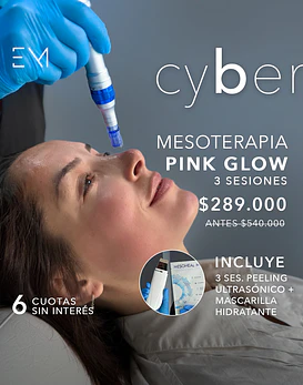 3 sesiones de mesoterapia PinkGlow + 3 ses Peeling ultrasonico + Mascara hidratante