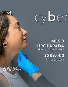 Lipolax, Mesolipopapada 3 sesiones