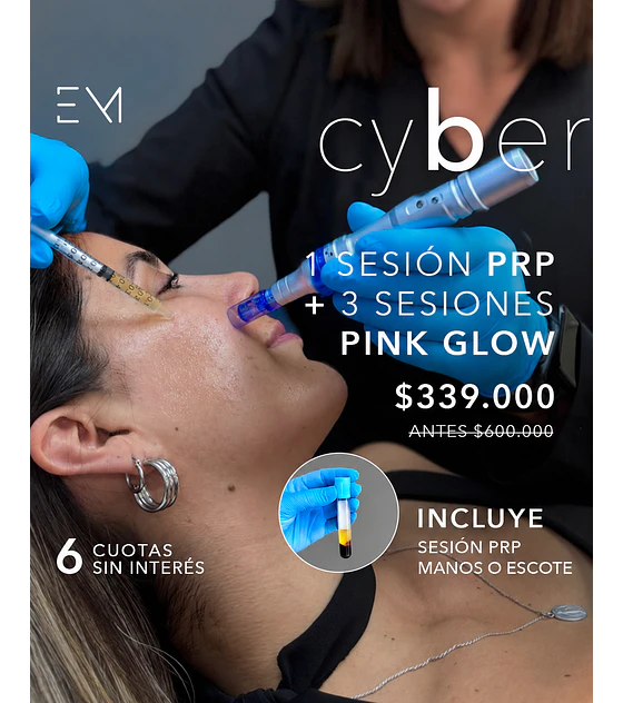 Prp facial + 3 mesoterapias pink glow