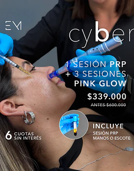 Prp facial + 3 mesoterapias pink glow