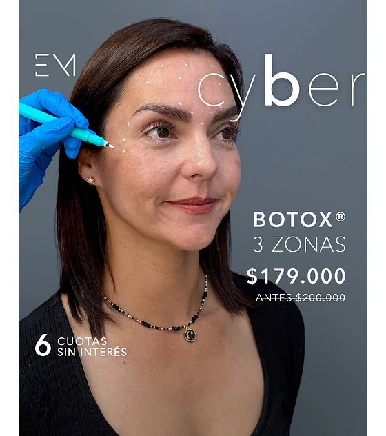 Toxina Botulínica para eliminar arrugas