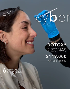 Toxina Botulínica 2 zonas