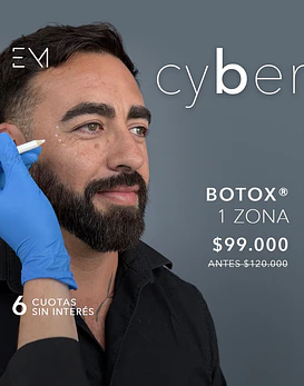 Toxina Botulínica Botox® 1 zona