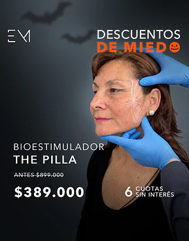 Bioestimulación con ácido poli-L-láctico Pilla