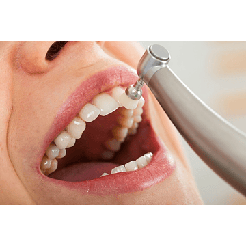 Limpieza dental 