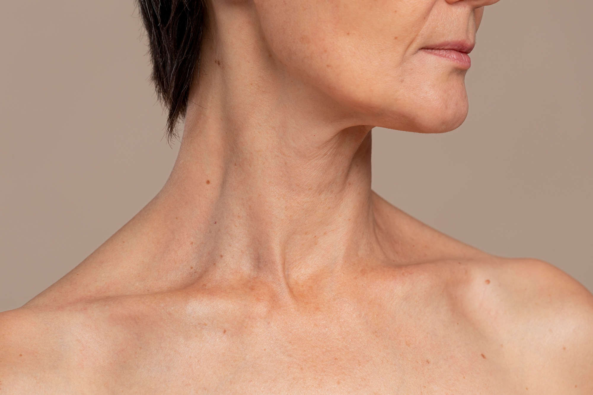Cuello de Nefertiti
