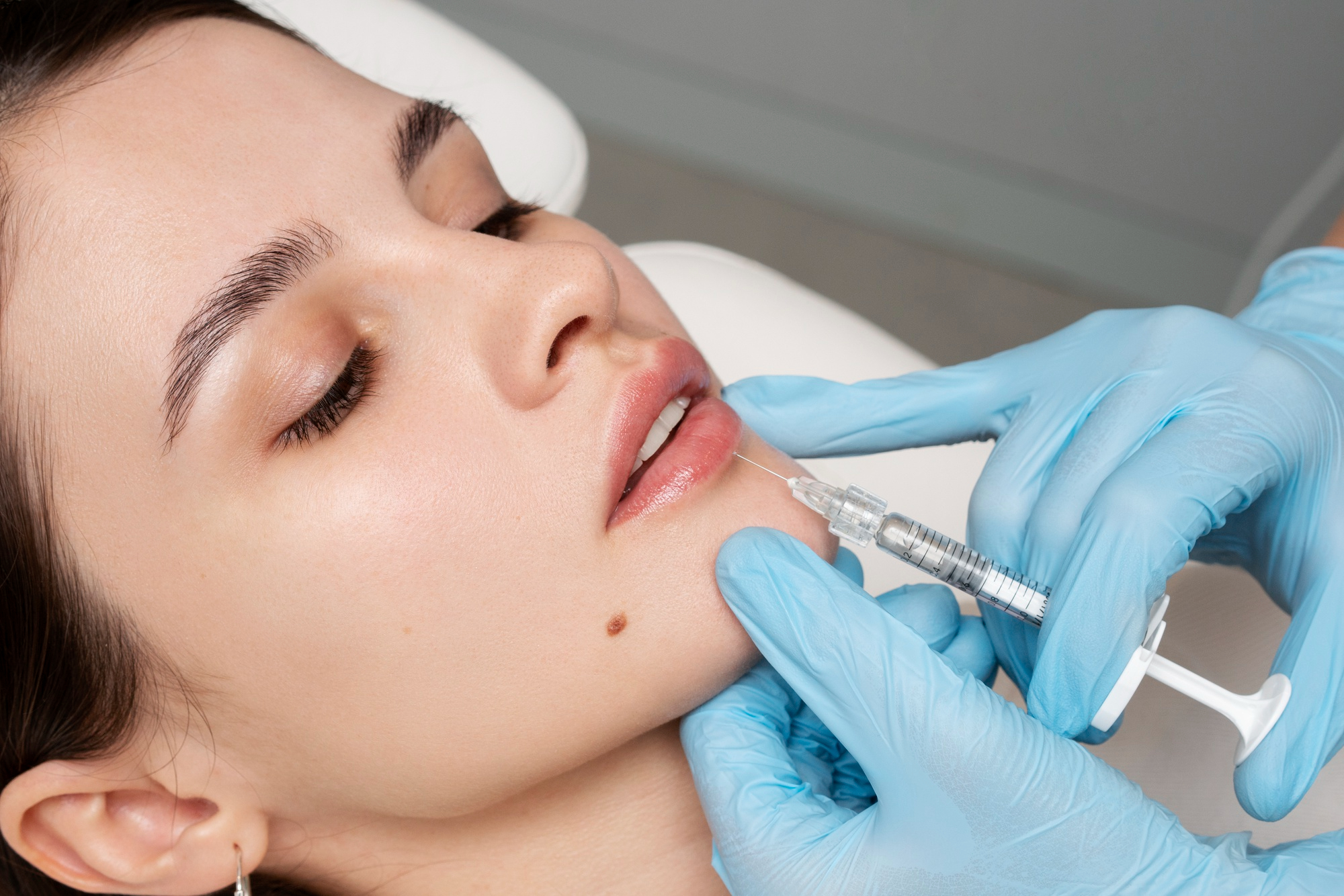 Perfilado de Labios