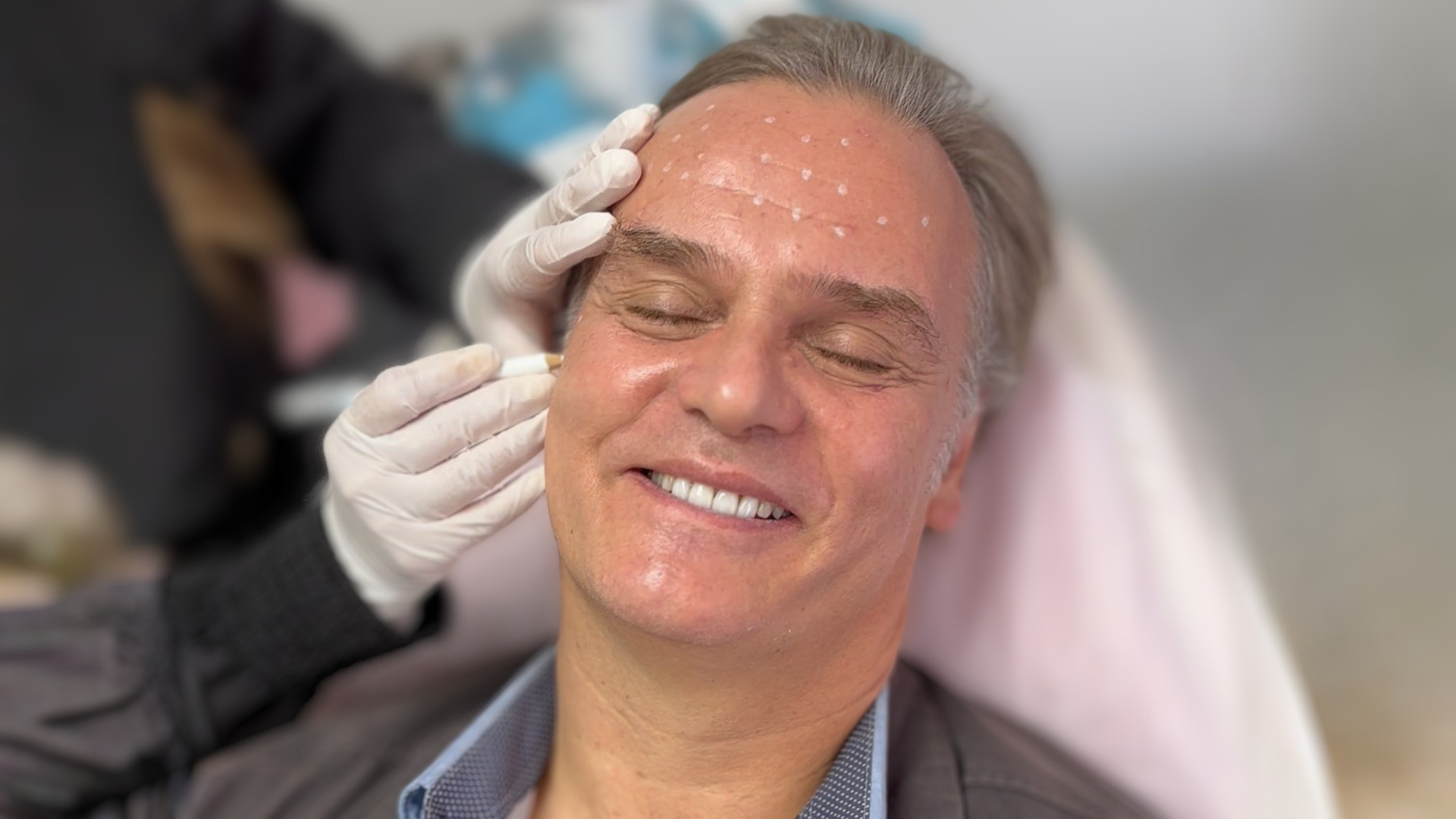 Amaro Gómez Pablos – Botox masculino NutraPiel