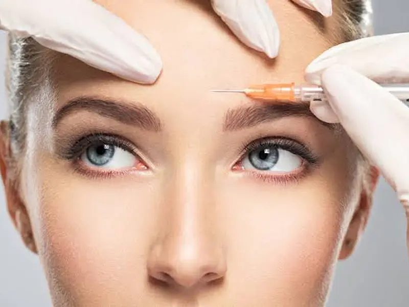 ¿Bótox preventivo o correctivo? Cómo saber cuál es el adecuado según tu edad y piel