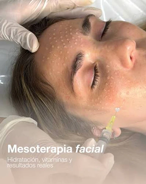 Mesoterapia BioRegenerativa