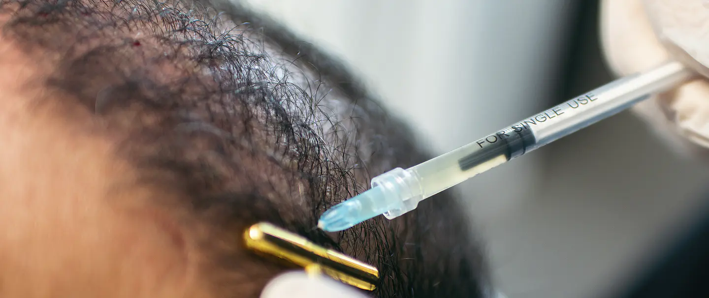 Pack Caída del Pelo 1
