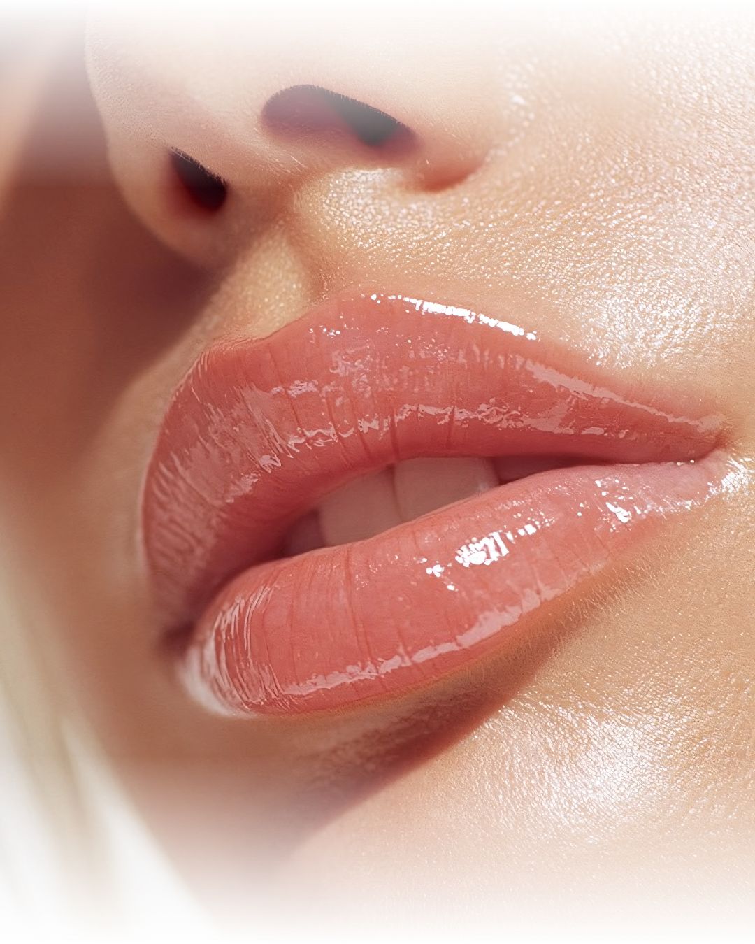 Perfilado y Volumen de Labios