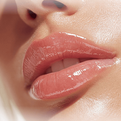 Aumento y Perfilado de Labios