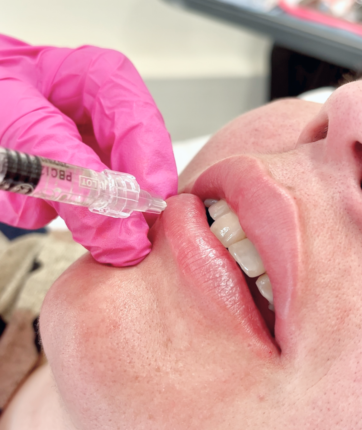 Perfilado y Volumen de Labios