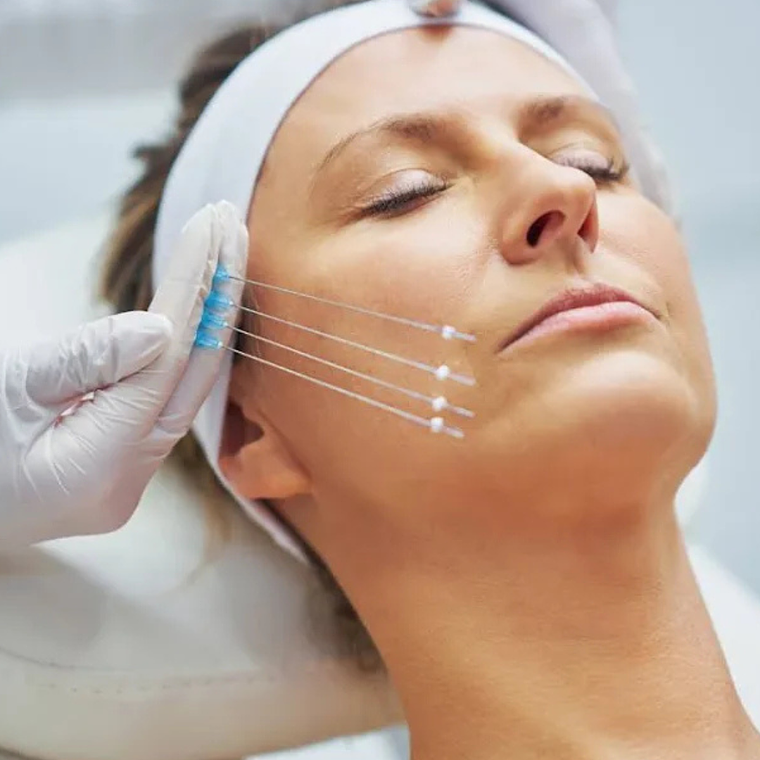 Hilos Tensores 4 unidades 1