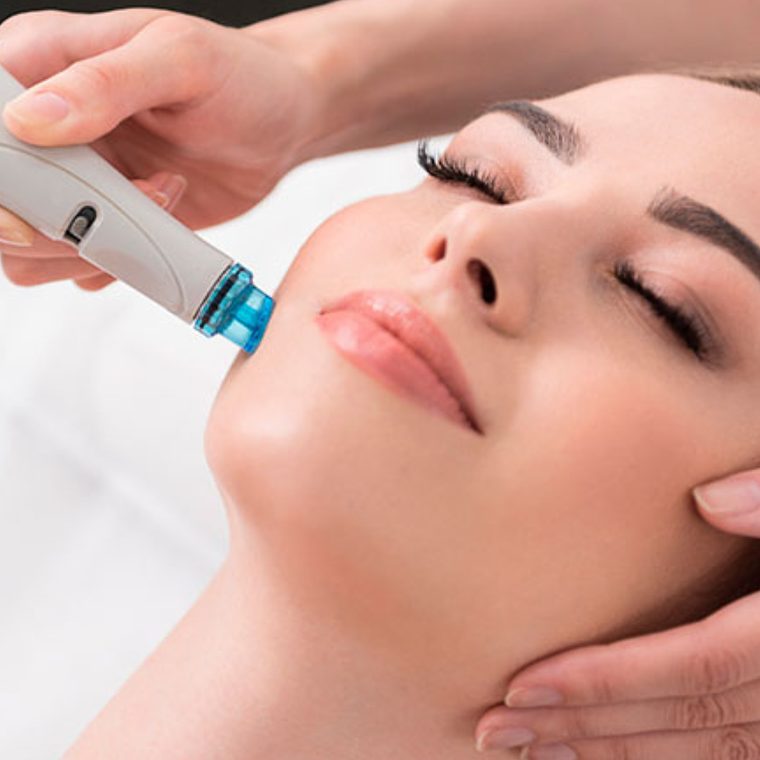 Terapia de Hidratación con Hydrafacial – 1 sesión 1
