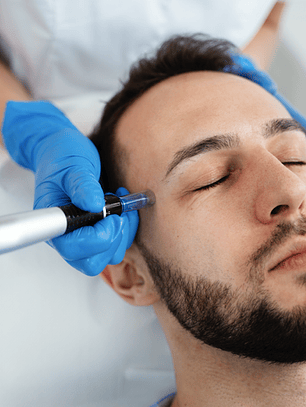 Terapia de Hidratación con Hydrafacial – 3 sesiones