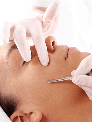 Dermaplaning – 1 sesión