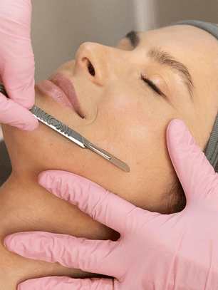 Dermaplaning – 3 sesiones