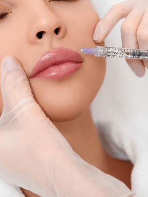 HIDRATACIÓN O RELLENO DE LABIOS