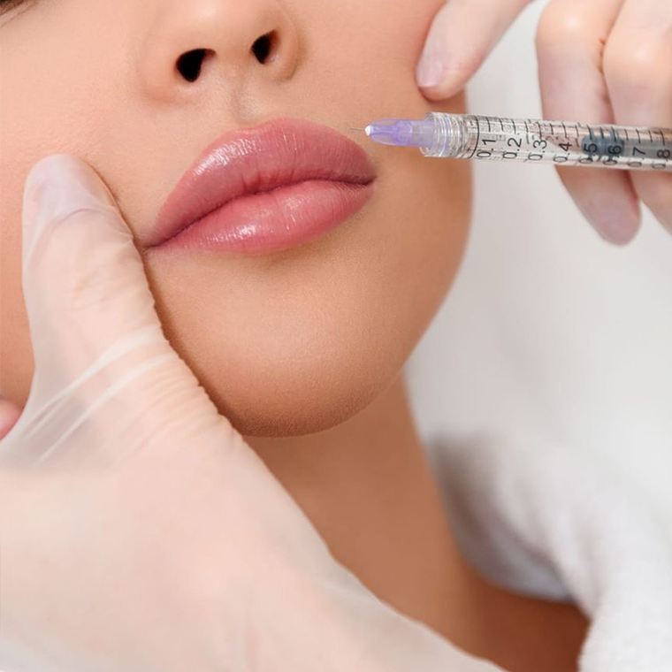 HIDRATACIÓN O RELLENO DE LABIOS 1