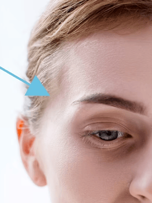 RELLENO ZONA TEMPORAL