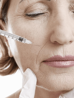 RELLENO SURCO NASOGENIANO