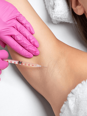 HIPERHIDROSIS AXILAR Y PALMAR