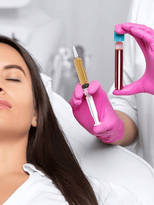 PLASMA RICO EN PLAQUETAS (PRP) – 1 SESIÓN