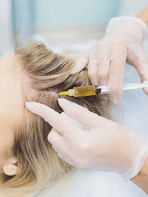 Plasma Rico en Plaquetas capilar (1 sesión) + Megadosis Vitaminas Hair Vital Boost (1 sesión) 