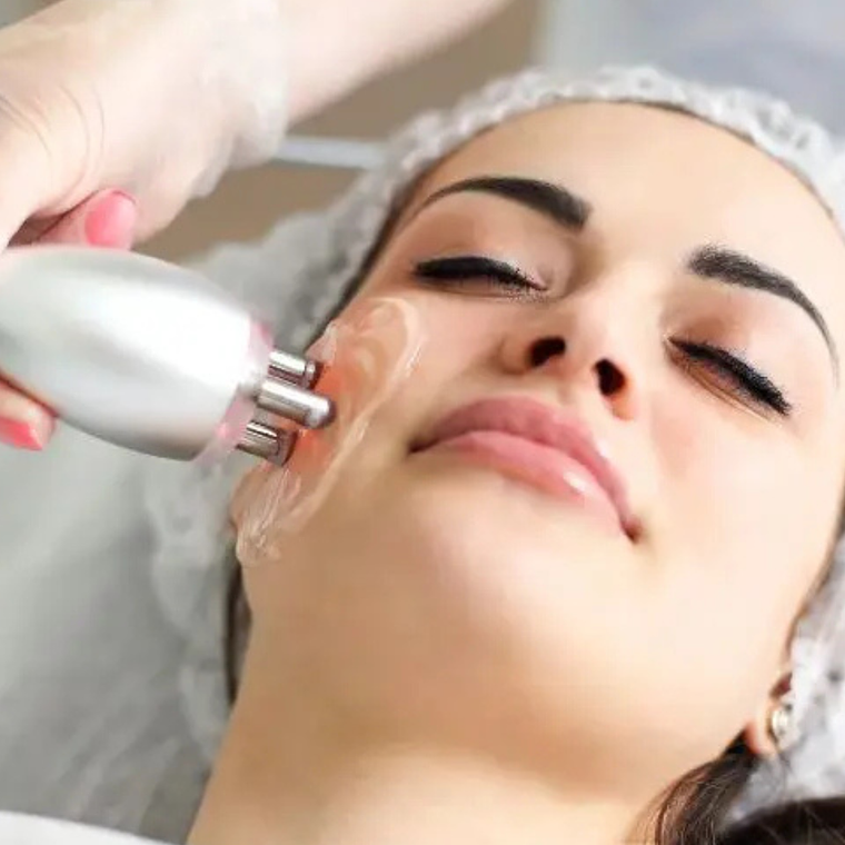 Radiofrecuencia rostro completo - 8 sesiones 1