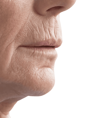 Código de barras - Hilos revitalizantes (desde 10 unidades)