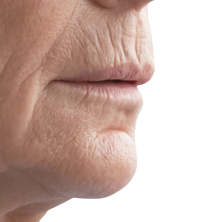 Código de barras - Hilos revitalizantes (desde 10 unidades) 1