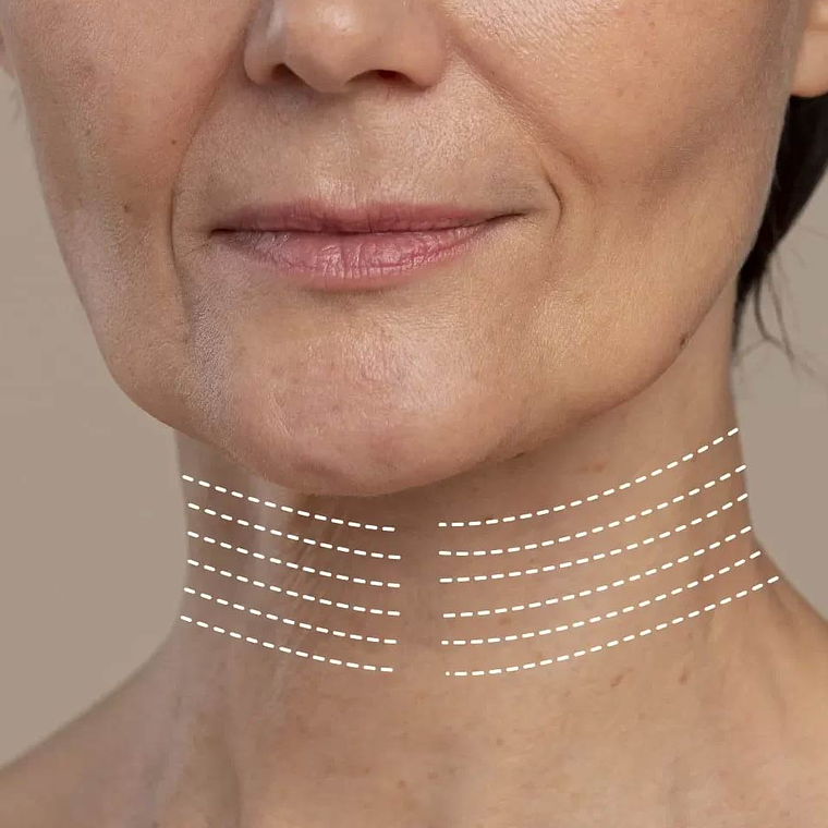 Cuello - Hilos revitalizantes (desde 20 unidades) 1