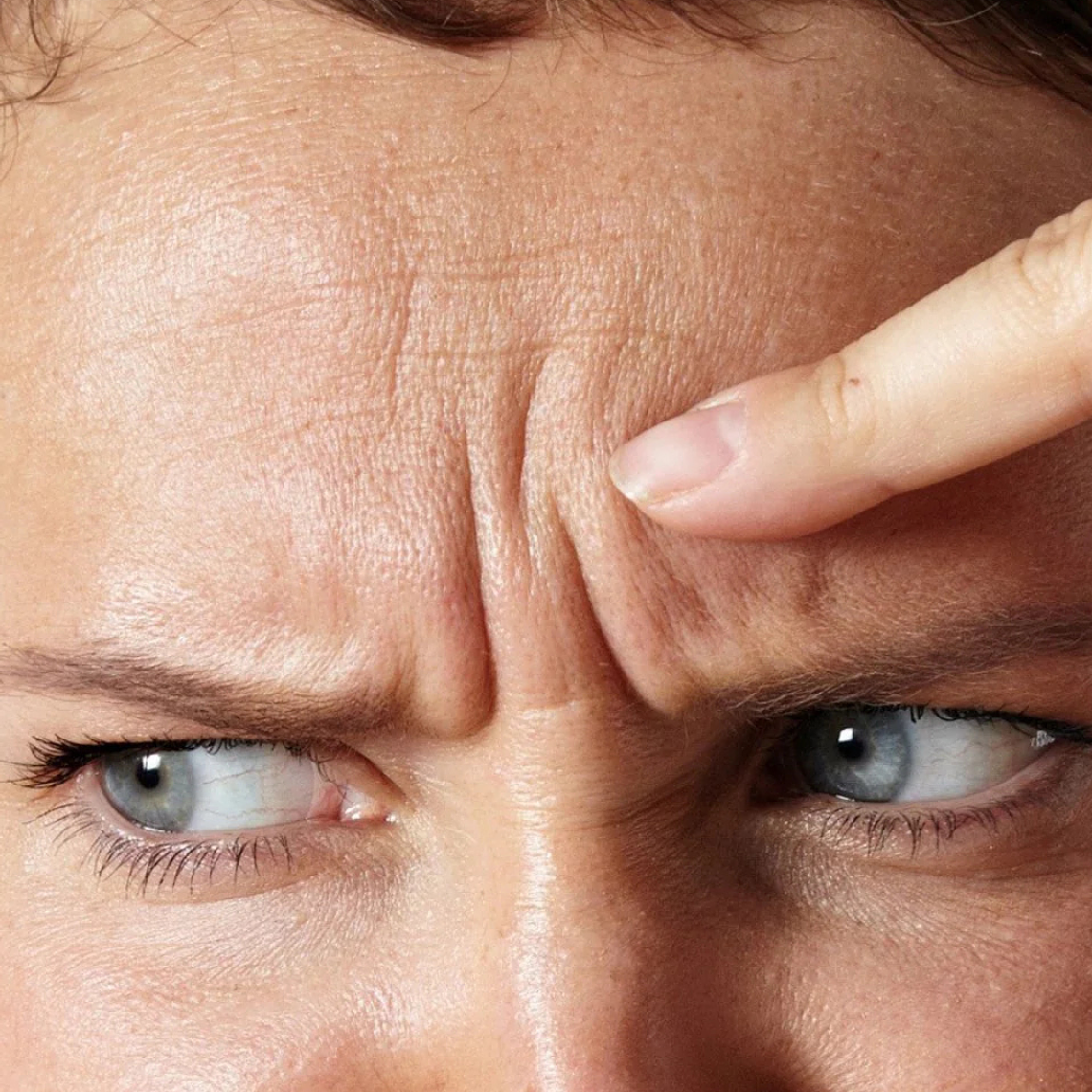 Entrecejo - Hilos revitalizantes (desde 5 unidades) 1