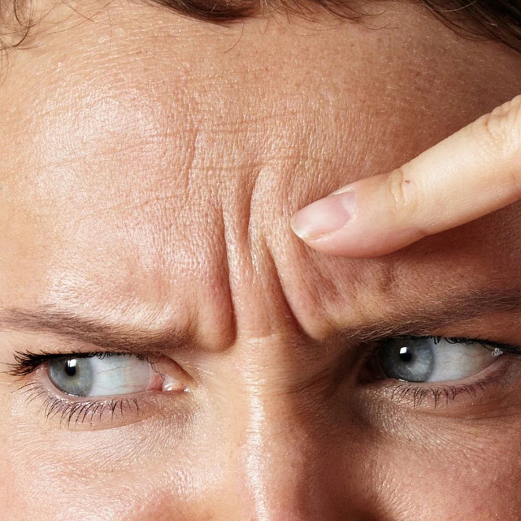 Entrecejo - Hilos revitalizantes (desde 5 unidades) 1