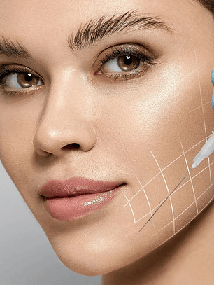 Mejillas - Hilos revitalizantes (desde 20 unidades)