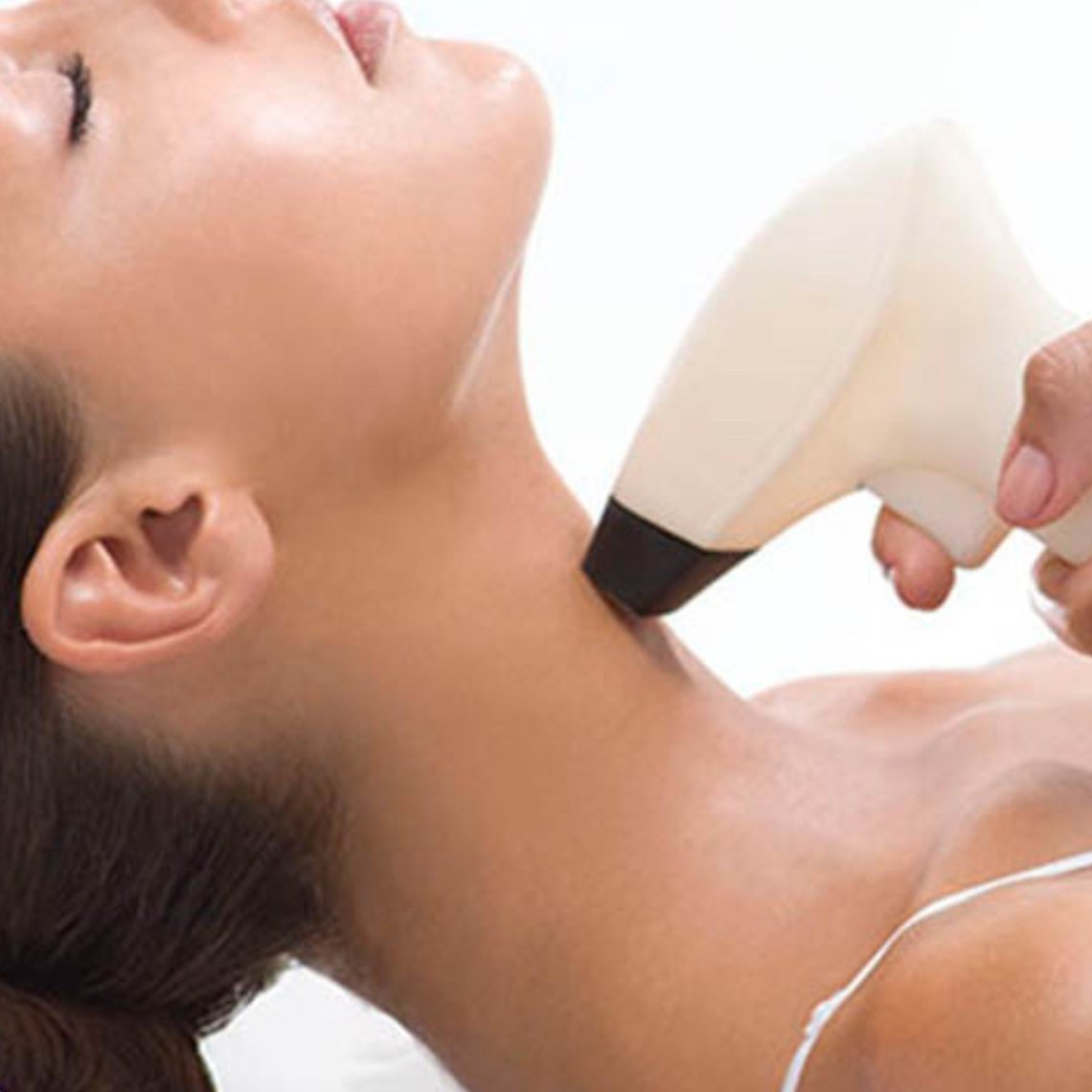 Radiofrecuencia papada - 8 sesiones 1