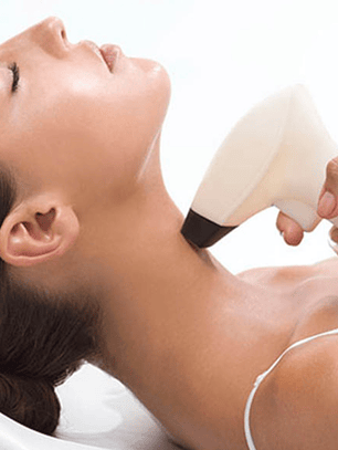 Radiofrecuencia papada - 8 sesiones